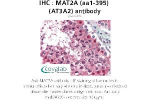 Image no. 2 for anti-Methionine Adenosyltransferase II, alpha (MAT2A) (AA 1-395) antibody (ABIN1724355) (MAT2A 抗体  (AA 1-395))