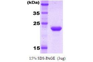 SDS-PAGE (SDS) image for Killer Cell Immunoglobulin-Like Receptor, Two Domains, Long Cytoplasmic Tail, 1 (KIR2DL1) protein (ABIN666833) (KIR2DL1 蛋白)