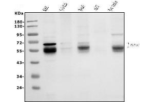 Western blot analysis of MEF2C using anti-MEF2C antibody (ABIN6719606).