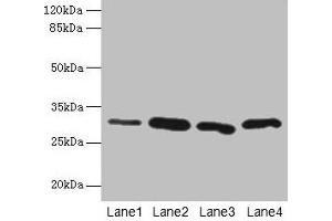 Western blot All lanes: CA3 antibody at 2 μg/mL Lane 1: Hela whole cell lysate Lane 2: HepG2 whole cell lysate Lane 3: K562 whole cell lysate Lane 4: NIH/3T3 whole cell lysate Secondary Goat polyclonal to rabbit IgG at 1/10000 dilution Predicted band size: 30 kDa Observed band size: 30 kDa (CA3 抗体  (AA 2-260))