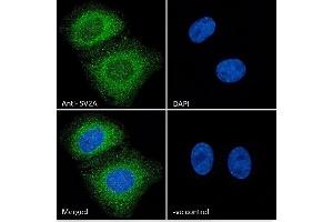 Immunofluorescence (IF) image for anti-Synaptic Vesicle Glycoprotein 2A (SV2A) (Internal Region) antibody (ABIN185715)