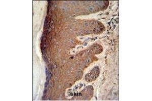Immunohistochemistry (Paraffin-embedded Sections) (IHC (p)) image for anti-Pyruvate Kinase M2 (PKM2) (AA 383-417), (C-Term) antibody (ABIN6242815)
