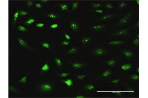 Immunofluorescence of purified MaxPab antibody to RRS1 on HeLa cell. (RRS1 抗体  (AA 1-365))