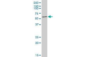 ARHGEF5 MaxPab rabbit polyclonal antibody. (ARHGEF5 抗体  (AA 1-519))