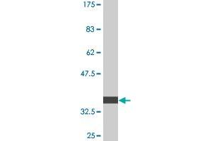 Western Blot detection against Immunogen (36. (PIK3R4 抗体  (AA 1259-1358))