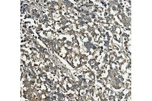 IHC analysis of Clathrin heavy chain/CLTC using anti-Clathrin heavy chain/CLTC antibody (ABIN7602703). (Clathrin Heavy Chain (CLTC) (AA 967-1668) 抗体)