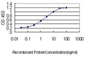 Detection limit for recombinant GST tagged CETN3 is approximately 0. (CETN3 抗体  (AA 1-100))