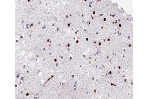ABIN6266483 at 1/200 staining human brain tissue sections by IHC-P. (HNRNPD/AUF1 抗体  (Internal Region))