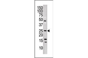 The anti-DUSP13 Pab (ABIN1882074 and ABIN2842284) is used in Western blot to detect DUSP13 in human CEM lysate.