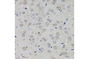 Immunohistochemistry of paraffin-embedded rat brain using AMPD1 antibody. (AMPD1 抗体)