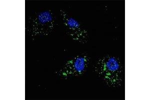 Fluorescent image of U251 cells stained with p62 antibody at 1:200. (SQSTM1 抗体  (AA 317-346))