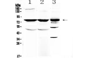 Western blot analysis of NSF using anti-NSF antibody . (NSF 抗体  (AA 620-744))