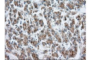 Immunohistochemistry (IHC) image for anti-Mitochondrial Translational Release Factor 1-Like (MTRF1L) antibody (ABIN1498695) (MTRF1L 抗体)