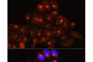 Immunofluorescence analysis of HeLa cells using GOLGA4 Polyclonal Antibody at dilution of 1:100 (40x lens). (GOLGA4 抗体)
