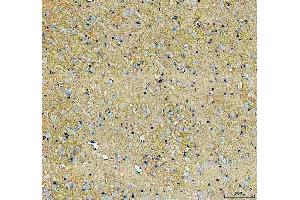 IHC analysis of SLC6A1 using anti-SLC6A1 antibody (ABIN5518957).