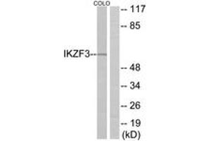 Western Blotting (WB) image for anti-IKAROS Family Zinc Finger 3 (Aiolos) (IKZF3) (AA 361-410) antibody (ABIN2889804) (IKZF3 抗体  (AA 361-410))