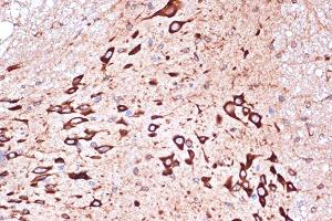 Immunohistochemistry of paraffin-embedded mouse spinal cord using PRKRA/PACTRabbit mAb (ABIN7269666) at dilution of 1:100 (40x lens). (PRKRA 抗体)