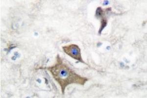 Image no. 2 for anti-Enolase 2 (Gamma, Neuronal) (ENO2) antibody (ABIN271752) (ENO2/NSE 抗体)