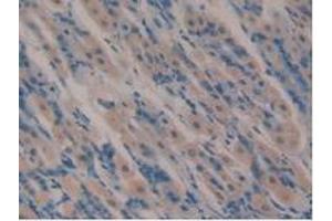 Detection of VIP in Mouse Stomach Tissue using Polyclonal Antibody to Vasoactive Intestinal Peptide (VIP) (Vip 抗体  (AA 28-159))