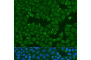 Immunofluorescence analysis of U2OS cells using KRT6B Polyclonal Antibody at dilution of 1:100.