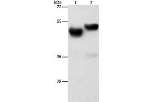 Western Blot analysis of Human fetal brain and liver tissue using AMZ1 Polyclonal Antibody at dilution of 1:1000 (AMZ1 抗体)