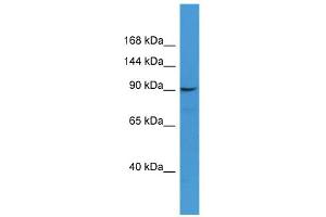 WB Suggested Anti-CD22 Antibody Titration: 0. (CD22 抗体  (N-Term))