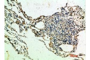 Immunohistochemical analysis of paraffin-embedded human-lung, antibody was diluted at 1:200 (THBS4 抗体  (AA 551-600))