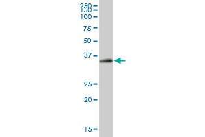 EPCAM MaxPab polyclonal antibody. (EpCAM 抗体  (AA 1-314))