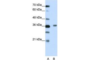 Western Blotting (WB) image for anti-BTB (POZ) Domain Containing 6 (BTBD6) antibody (ABIN2461967) (BTBD6 抗体)