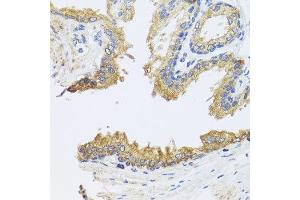 Immunohistochemistry of paraffin-embedded human prostate using ARL6 antibody at dilution of 1:100 (x40 lens). (ARL6 抗体)