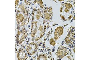 Immunohistochemistry of paraffin-embedded human stomach using CCNA2 antibody (ABIN1871532) at dilution of 1:100 (40x lens). (Cyclin A 抗体)