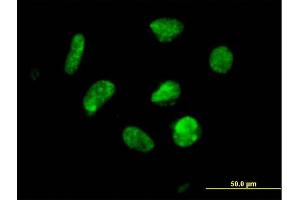 Immunofluorescence of purified MaxPab antibody to ZNF302 on HeLa cell. (ZNF302 抗体  (AA 1-399))