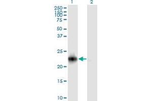 Western Blot analysis of RRAS2 expression in transfected 293T cell line by RRAS2 monoclonal antibody (M01A), clone 2D3-4B8. (RRAS2 抗体  (AA 1-204))