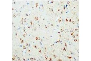 Immunohistochemical analysis of paraffin embedded rat tissue sections (brain), staining NGFbeat in cytoplasm, DAB chromogenic reaction (Nerve Growth Factor 抗体  (N-Term))