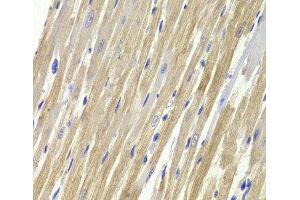 Immunohistochemistry of paraffin-embedded Rat heart using GPD1 Polyclonal Antibody at dilution of 1:100 (40x lens). (GPD1 抗体)