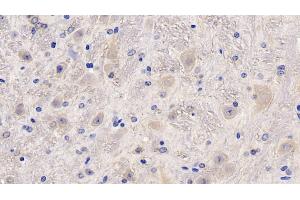 Detection of MCSF in Mouse Cerebellum Tissue using Polyclonal Antibody to Colony Stimulating Factor 1, Macrophage (MCSF) (M-CSF/CSF1 抗体  (AA 261-427))