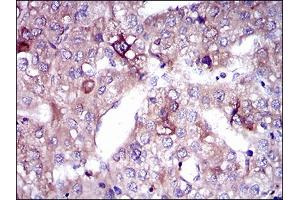 Immunohistochemistry (IHC) image for anti-Solute Carrier Family 27 (Fatty Acid Transporter), Member 5 (SLC27A5) (AA 508-570) antibody (ABIN1724761)