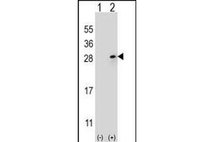 Western blot analysis of FGF9 (arrow) using rabbit polyclonal FGF9 Antibody (N-term) (ABIN654171 and ABIN2844030). (FGF9 抗体  (N-Term))