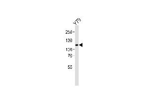 Western blot analysis of lysate from Y79 cell line, using ANKRD24 Antibody (Center) (ABIN6244224 and ABIN6577526). (ANKRD24 抗体  (AA 296-328))