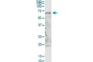 Western Blotting (WB) image for anti-Zinc Finger Protein 238 (ZNF238) (AA 1-522) antibody (ABIN523881)