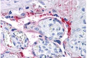 Human Placenta: Formalin-Fixed, Paraffin-Embedded (FFPE) (Integrin beta 3 抗体)
