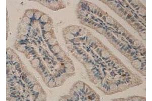 Immunohistochemical staining of formalin-fixed paraffin-embedded human small intestine tissue with ADAM17 polyclonal antibody  at 1 : 100 dilution. (ADAM17 抗体  (C-Term))