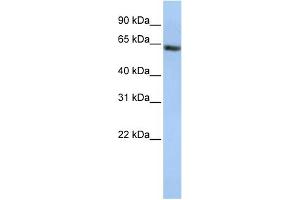 WB Suggested Anti-FANCE Antibody Titration: 0. (FANCE 抗体  (Middle Region))