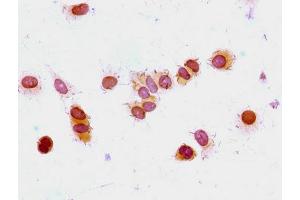 Immunocytochemistry analysis of MCF-7 cells using ABIN7139177 at dilution of 1:100 (HIST1H1E 抗体  (acLys33))