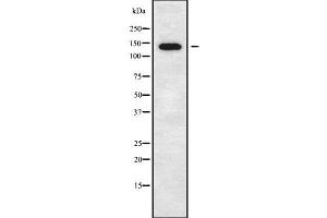 Western blot analysis of CTNND2 using COLO205 whole cell lysates (CTNND2 抗体  (C-Term))