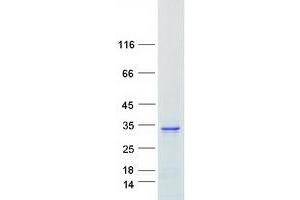 Western Blotting (WB) image for RAB26, Member RAS Oncogene Family (RAB26) protein (Myc-DYKDDDDK Tag) (ABIN2730306)