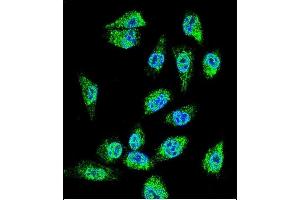 Confocal immunofluorescent analysis of MIC1 Antibody (N-term) (ABIN655711 and ABIN2845162) with MDA-MB cell followed by Alexa Fluor 488-conjugated goat anti-rabbit lgG (green). (C18orf8 抗体  (N-Term))