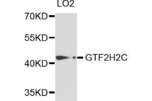 Western blot analysis of extracts of LO2 cells, using GTF2H2C antibody. (GTF2H2C 抗体)