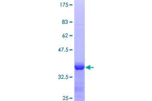 alpha 2 Macroglobulin Protein (AA 641-730) (GST tag)