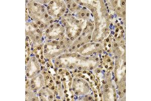 Immunohistochemistry of paraffin-embedded mouse kidney using HIRIP3 antibody at dilution of 1:100 (x400 lens). (HIRIP3 抗体)